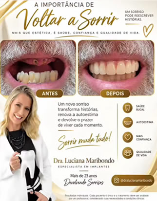 Implantes e próteses. Reabilitação oral, com Dra.Luciana-whatsApp Reabilitação oral, implantes, próteses dentárias