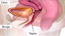 Fístula urinária tratamento e cirurgia Dr. Lincoln. dentistasrio.com.br/site/medicos-no-rio.php