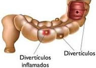 Divertículos uretrais tratamentos Dr. Lincoln. dentistasrio.com.br/site/medicos-no-rio.php