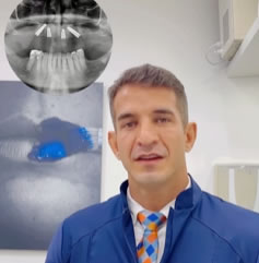Implantes com Dr. João Carvalho