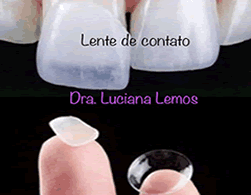 Dra.Luciana Tratamentos Estéticos Dentários, Lentes de contato, Clareamento dental