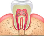 Endodontia - Tratamento de Canal dentistas em ipanema Dr. Rony Hansen