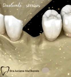 Dra.Luciana, especialista em implantes dentários - Dentistasrio.com.br