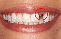 Facial Odontologia-implante dentário