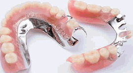 Próteses dentárias-Dr. João Carvalho