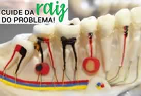 Endodontia na Oral Ipanpema