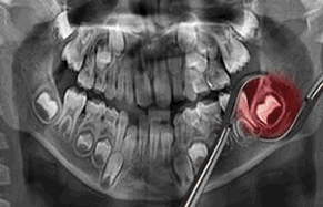 Cirugias- Oral Ipanpema