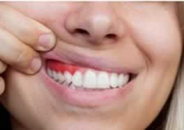 Periodontia,Oral Ipanpema