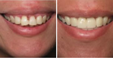 Reabilitação dentária, Oral Ipanema