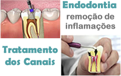 Dra. Rosângela. Endodontia Delivery, na Barra da Tijuca/ Recreio, para Clientes e Cir. Dentistas. Dentistasrio.com.br