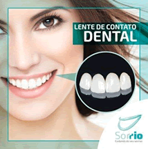 Lentes de Contato Dental. Clínica Sorrio