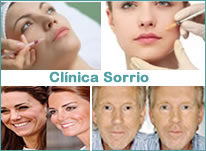 Estética Orofaciais, Preenchimento Facial. DentistasRio.com.br